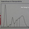 Tipica sieroelettroforesi in corso di leishmaniosi con picco beta-gamma